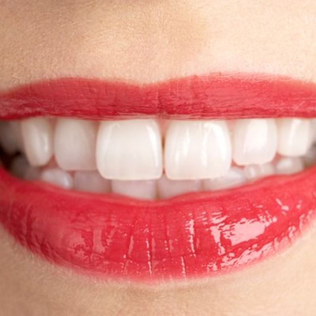 Implantes dentales en Cobeña | Clínica Dental Cobeña